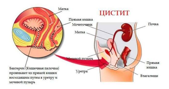 Настойка бобровой струи. Полезные свойства, приготовление, применение, от каких болезней