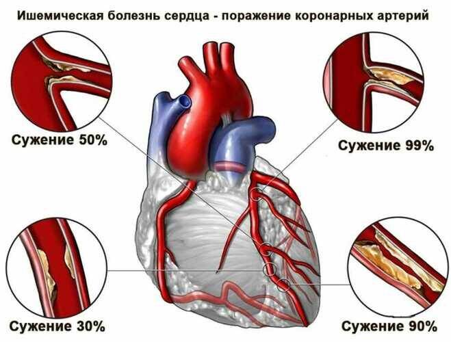 Настойка бобровой струи. Полезные свойства, приготовление, применение, от каких болезней