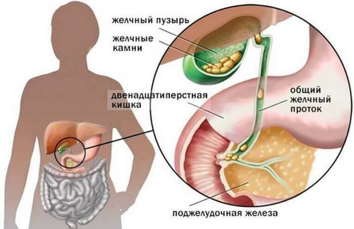 Настойка бобровой струи. Полезные свойства, приготовление, применение, от каких болезней