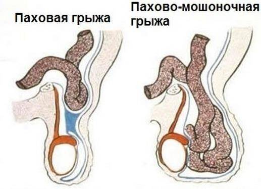 Лод терапия в урологии отзывы