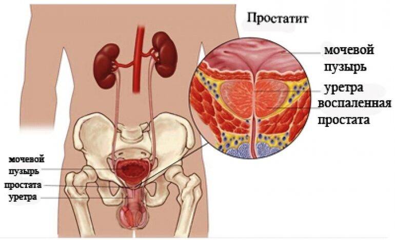 Причины боли в интимной зоне у мужчин