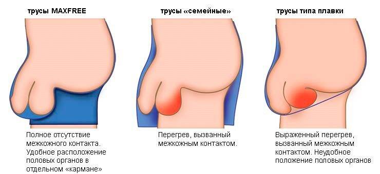 Какое нужно носить белье?