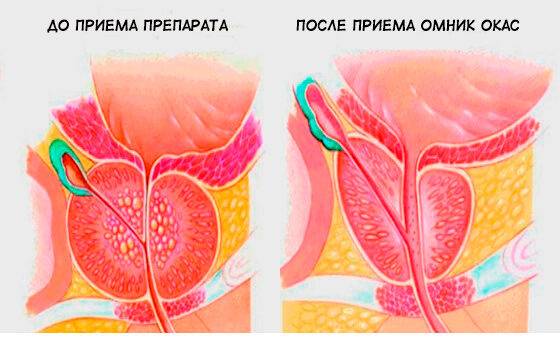 Принцип действия