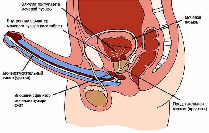 Ретроградная эякуляция