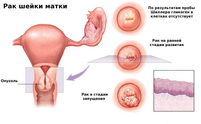 Шейка матки. Фото внутри, строение, норма размеров здоровой при беременности, перед родами, месячными