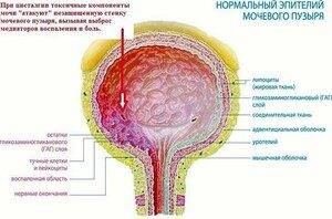 Признаки заболевания