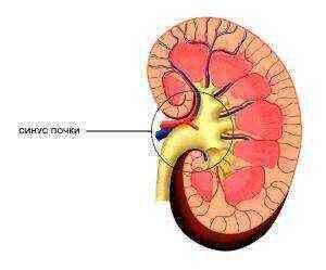 синусные кисты почек