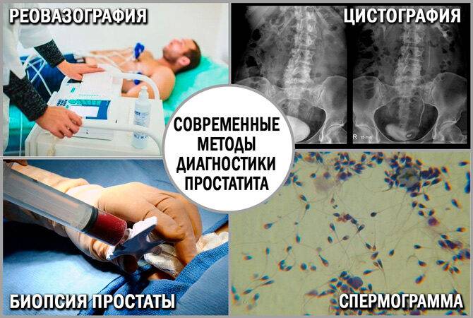 Диагностика простатита: методы исследования