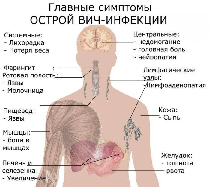 СПИД. Как передается от человека к человеку, симптомы, признаки, лечение