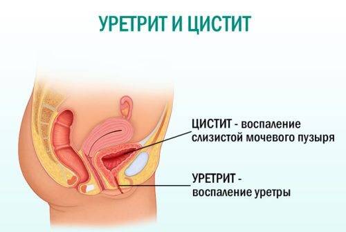 Запах аммиака в моче у женщин. Почему это происходит и как лечить