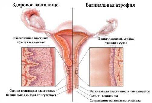 Чешутся половые губы