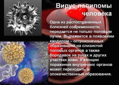 Что такое папиллома шейки матки, причины, симптомы, лечение