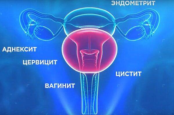 Вобэнзим. Инструкция по применению в гинекологии. Отзывы, цена, аналоги таблеток