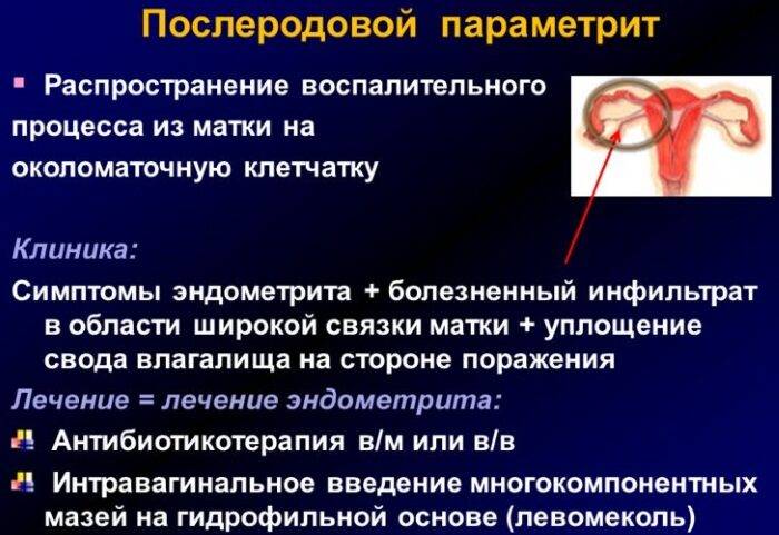 Воспаления по-женски придатков, почек, яичников, мочевого пузыря, лимфоузлов в паху, симптомы и лечение