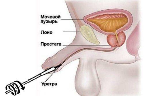 Урологический мазок на флору у мужчин