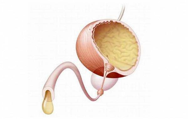 Нарушение мочеиспускания у мужчин: виды и лечение
