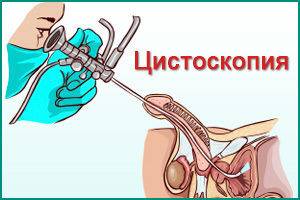 Процедура цистоскопии